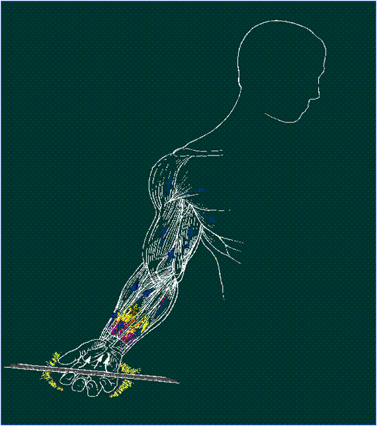 Chicago Electrical Trauma Rehabilitation Institute