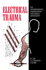 electrical_trauma_book